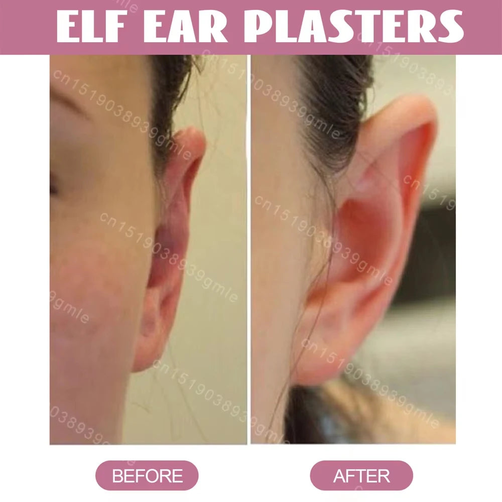 Invisible Ear Corrector Stickers